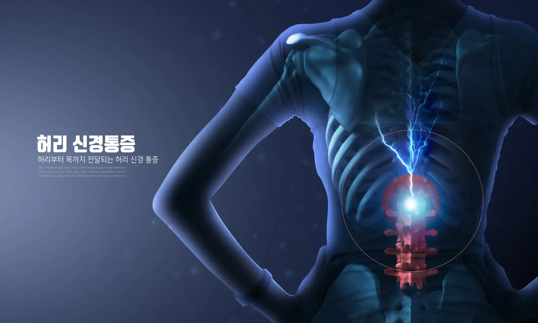 医院现代医学医疗科技骨骼关节风湿肌肉疼痛宣传海报PSD设计素材-爱设计爱分享c